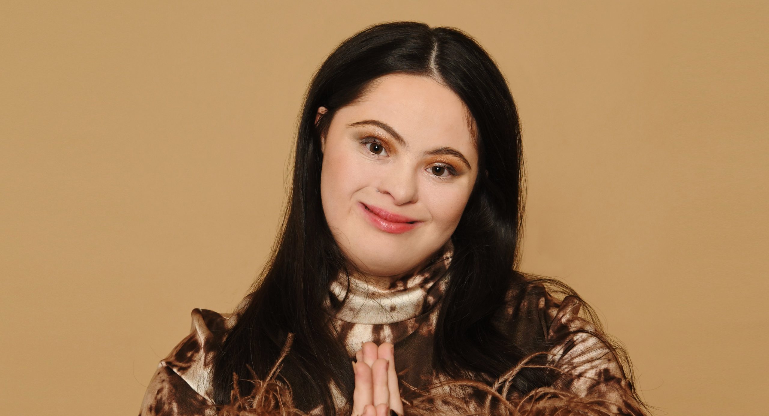 Ellie Goldstein – Net Worth and Future Beyond Strictly